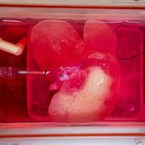 Lab-grown mini-livers bring us closer to an organ donor-free future