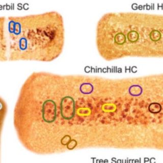 Coronavirus: Scientists Are Questioning Past Research By The Founder of Surgisphere