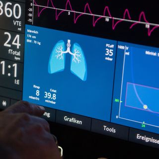 Some covid-19 patients taken off ventilators are taking days or even weeks to wake up