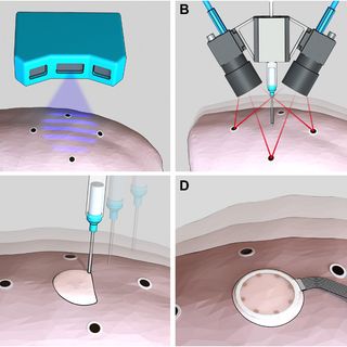 3D printed deformable sensors