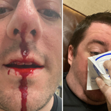 Man left bloodied after defending woman from racist tirade at San Antonio gym