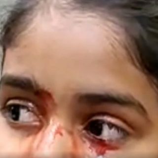 11-year-old girl cries blood for a week, baffling doctors