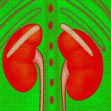 Chronic kidney disease kills more than 1M people annually worldwide