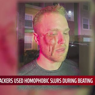 Metro realtor beaten unconscious while attackers yell homophobic slurs