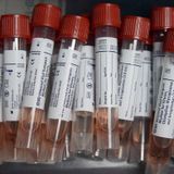 Pooling Coronavirus Tests Can Spare Scarce Supplies, But There's A Catch