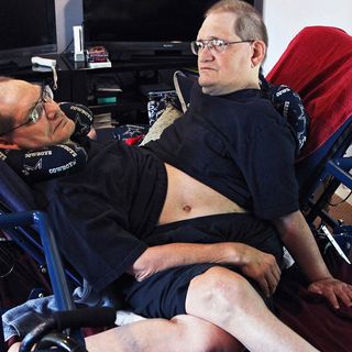 Brother of longest-surviving conjoined twins speaks after their deaths