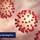First coronavirus autopsy highlights how illness targets lungs